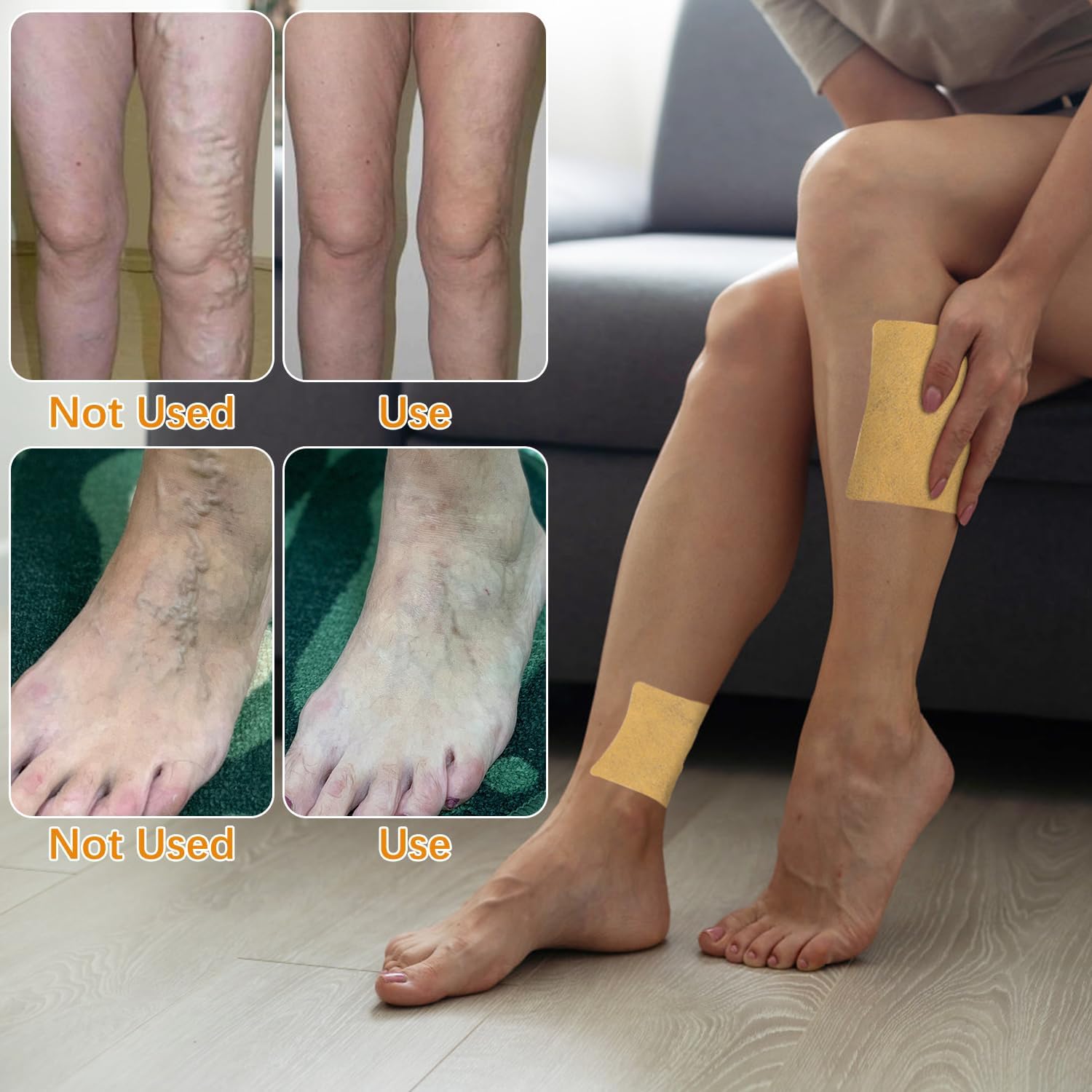 Turmeric Varicose Vein Patch (10 Pcs)